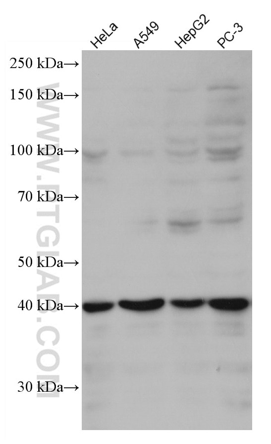 Western Blot (WB) analysis of various lysates using hIST1 Monoclonal antibody (66989-1-Ig)