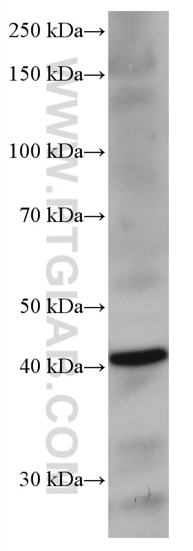 WB analysis of mouse liver using 66989-1-Ig