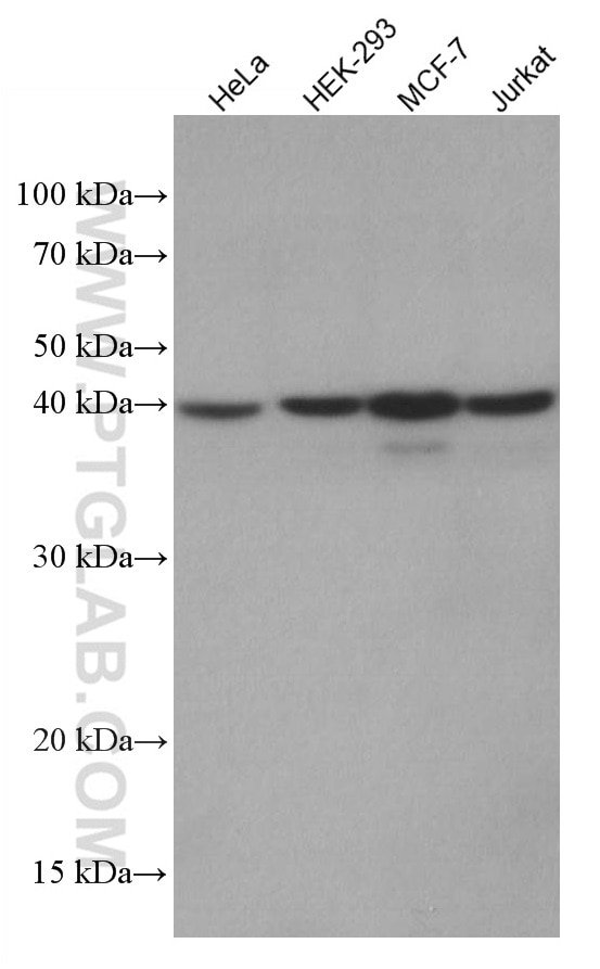 Western Blot (WB) analysis of various lysates using hIST1 Monoclonal antibody (66989-1-Ig)