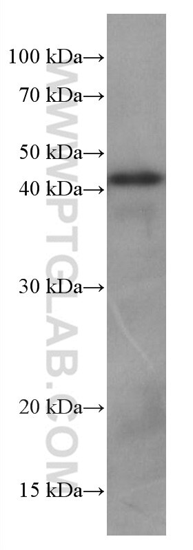 Western Blot (WB) analysis of HSC-T6 cells using hIST1 Monoclonal antibody (66989-1-Ig)