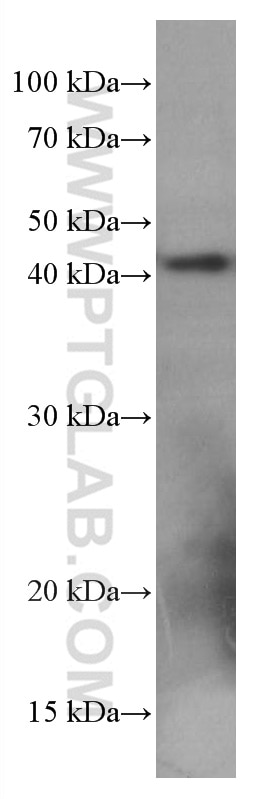 Western Blot (WB) analysis of NIH/3T3 cells using hIST1 Monoclonal antibody (66989-1-Ig)