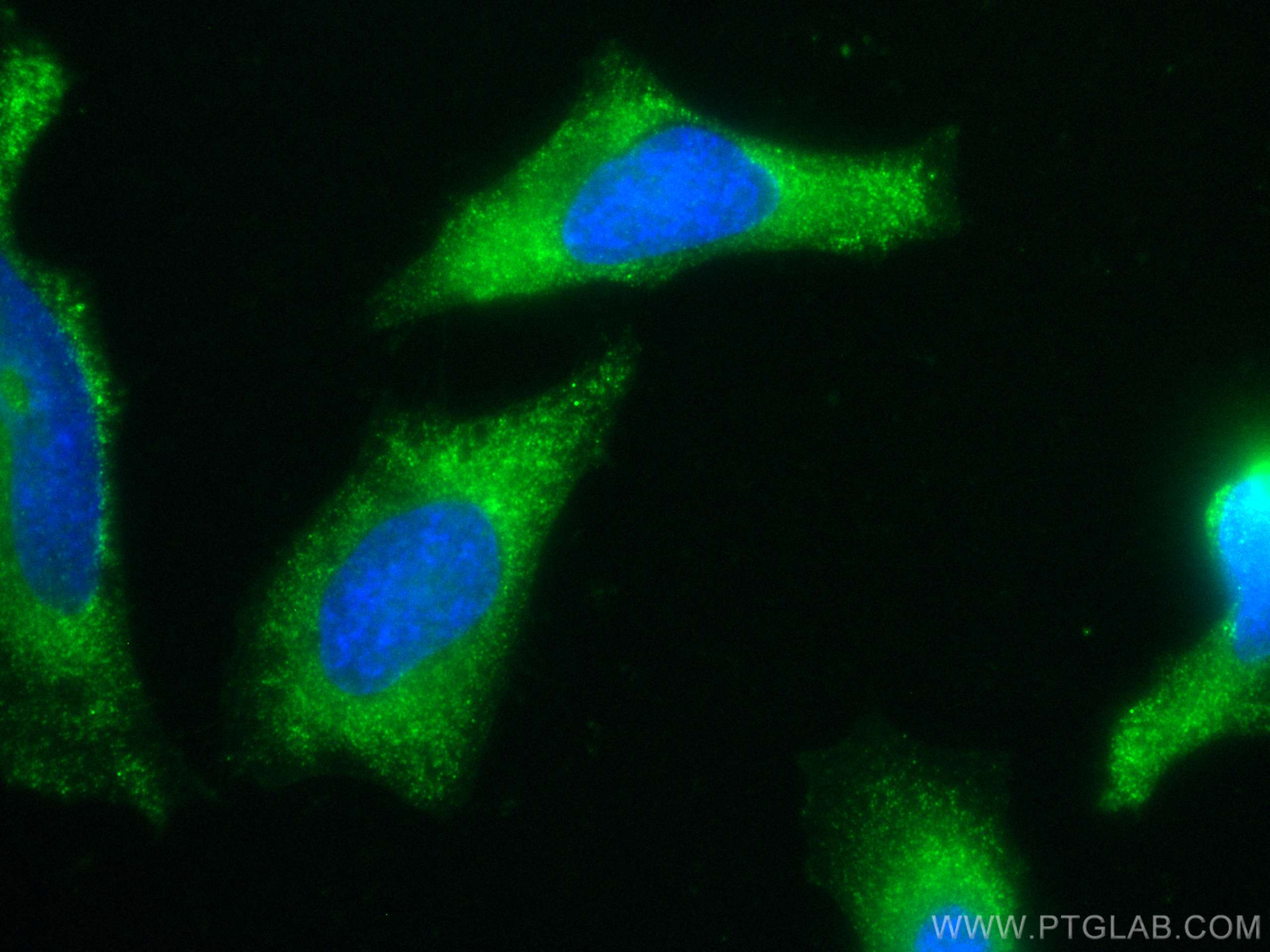 Immunofluorescence (IF) / fluorescent staining of HeLa cells using CoraLite® Plus 488-conjugated hIST1 Monoclonal ant (CL488-66989)