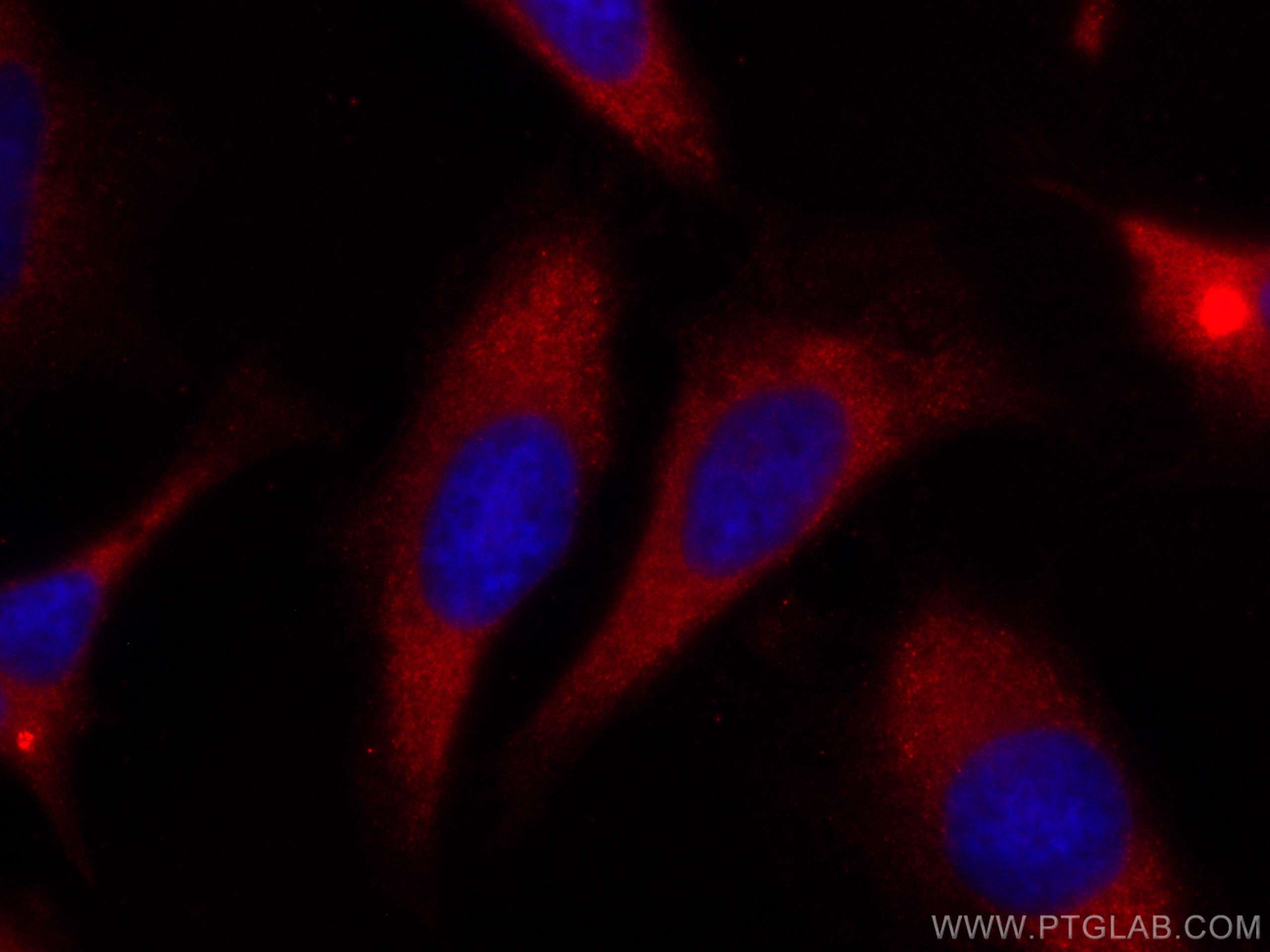 Immunofluorescence (IF) / fluorescent staining of HeLa cells using CoraLite®594-conjugated hIST1 Monoclonal antibody (CL594-66989)