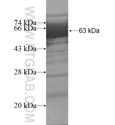 hIST1 fusion protein Ag13874 SDS-PAGE