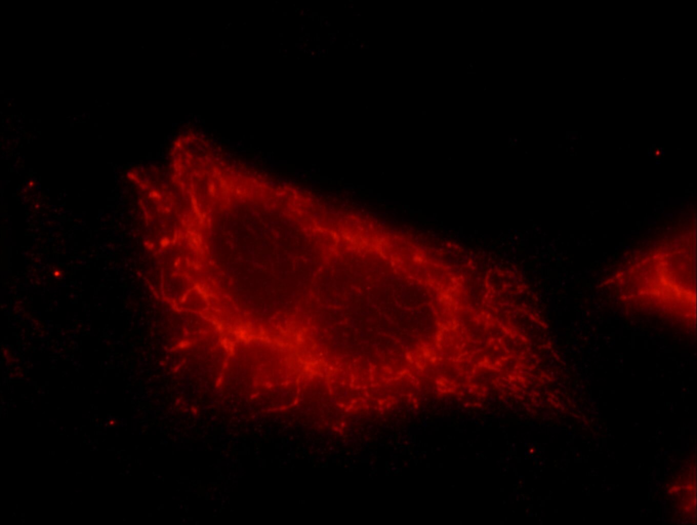 Immunofluorescence (IF) / fluorescent staining of HeLa cells using Hamartin/TSC1 Polyclonal antibody (20988-1-AP)