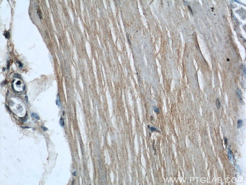 Immunohistochemistry (IHC) staining of human skeletal muscle tissue using Hamartin/TSC1 Polyclonal antibody (20988-1-AP)