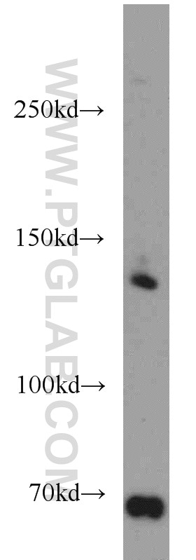 Western Blot (WB) analysis of HeLa cells using Hamartin/TSC1 Polyclonal antibody (20988-1-AP)