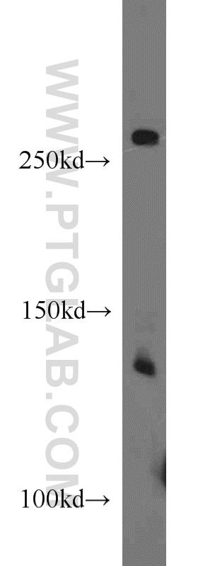 WB analysis of HeLa using 20988-1-AP