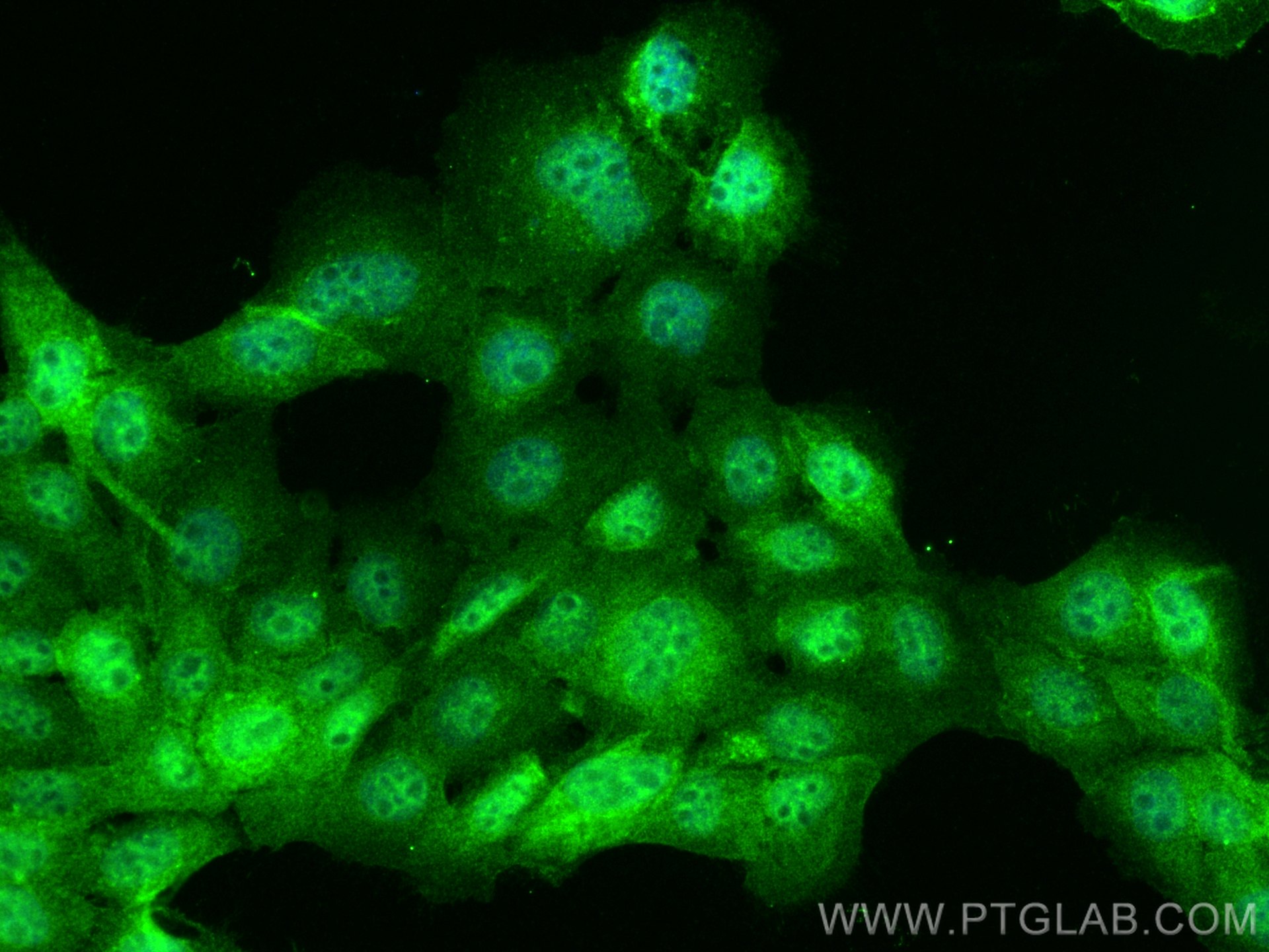 Immunofluorescence (IF) / fluorescent staining of A431 cells using hnRNP-E1 Polyclonal antibody (14523-1-AP)