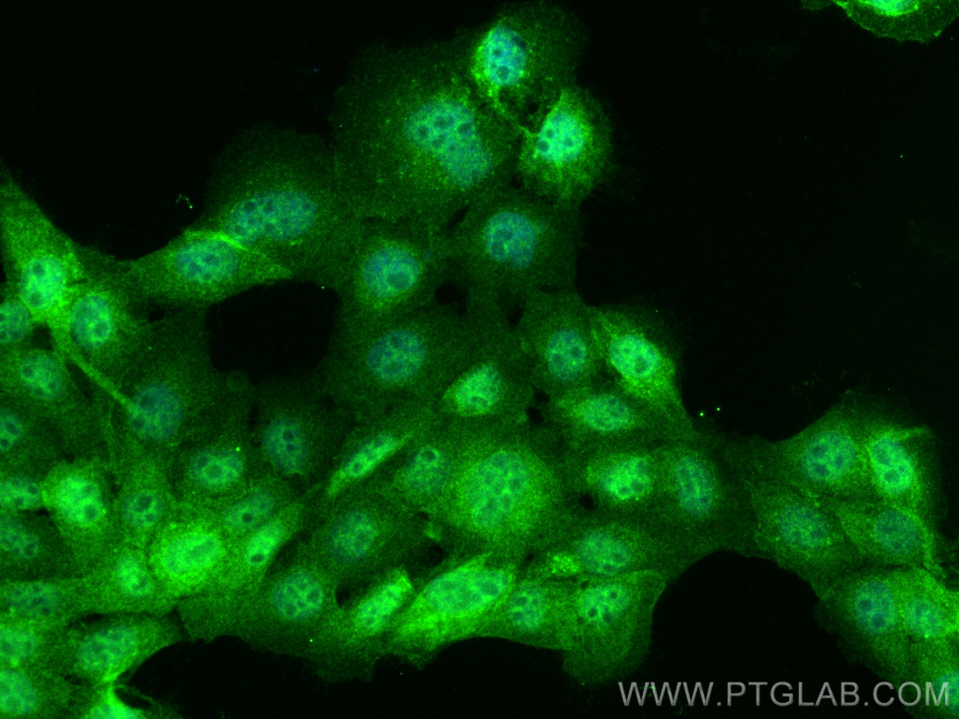 IF Staining of A431 using 14523-1-AP