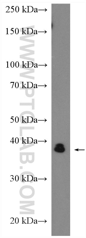 Western Blot (WB) analysis of K-562 cells using hnRNP-E1 Polyclonal antibody (14523-1-AP)