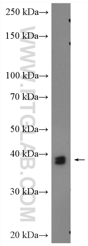 Western Blot (WB) analysis of MCF-7 cells using hnRNP-E1 Polyclonal antibody (14523-1-AP)