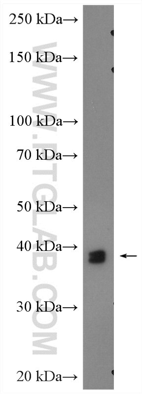 WB analysis of MCF-7 using 14523-1-AP