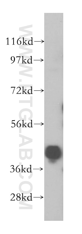 Western Blot (WB) analysis of HeLa cells using hnRNP-E1 Polyclonal antibody (14523-1-AP)