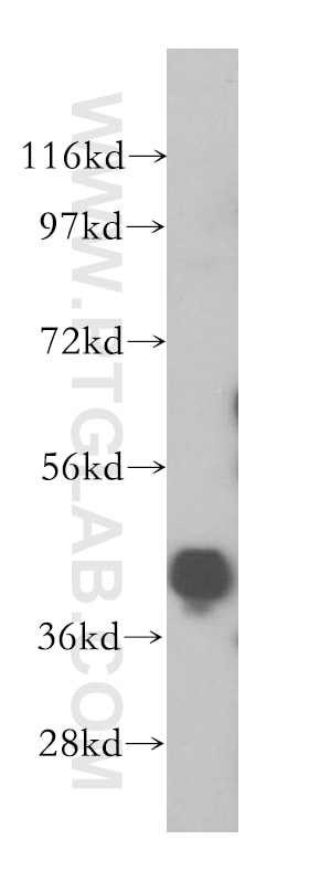 WB analysis of HeLa using 14523-1-AP