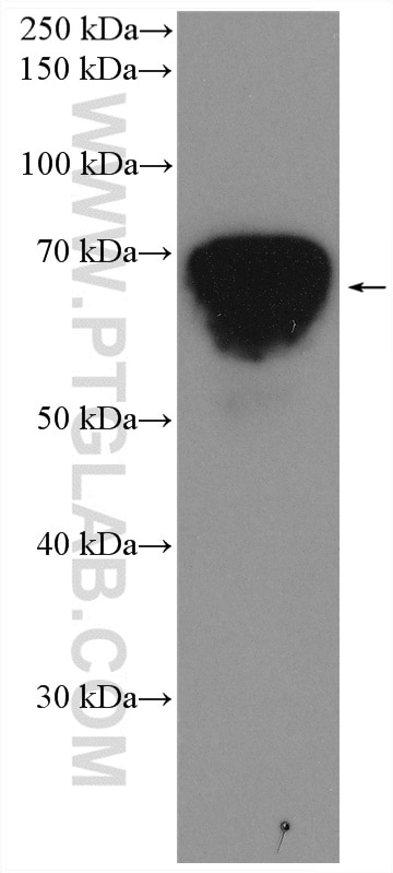 Western Blot (WB) analysis of human plasma using HRP-conjugated human IgD Monoclonal antibody (HRP-67538)