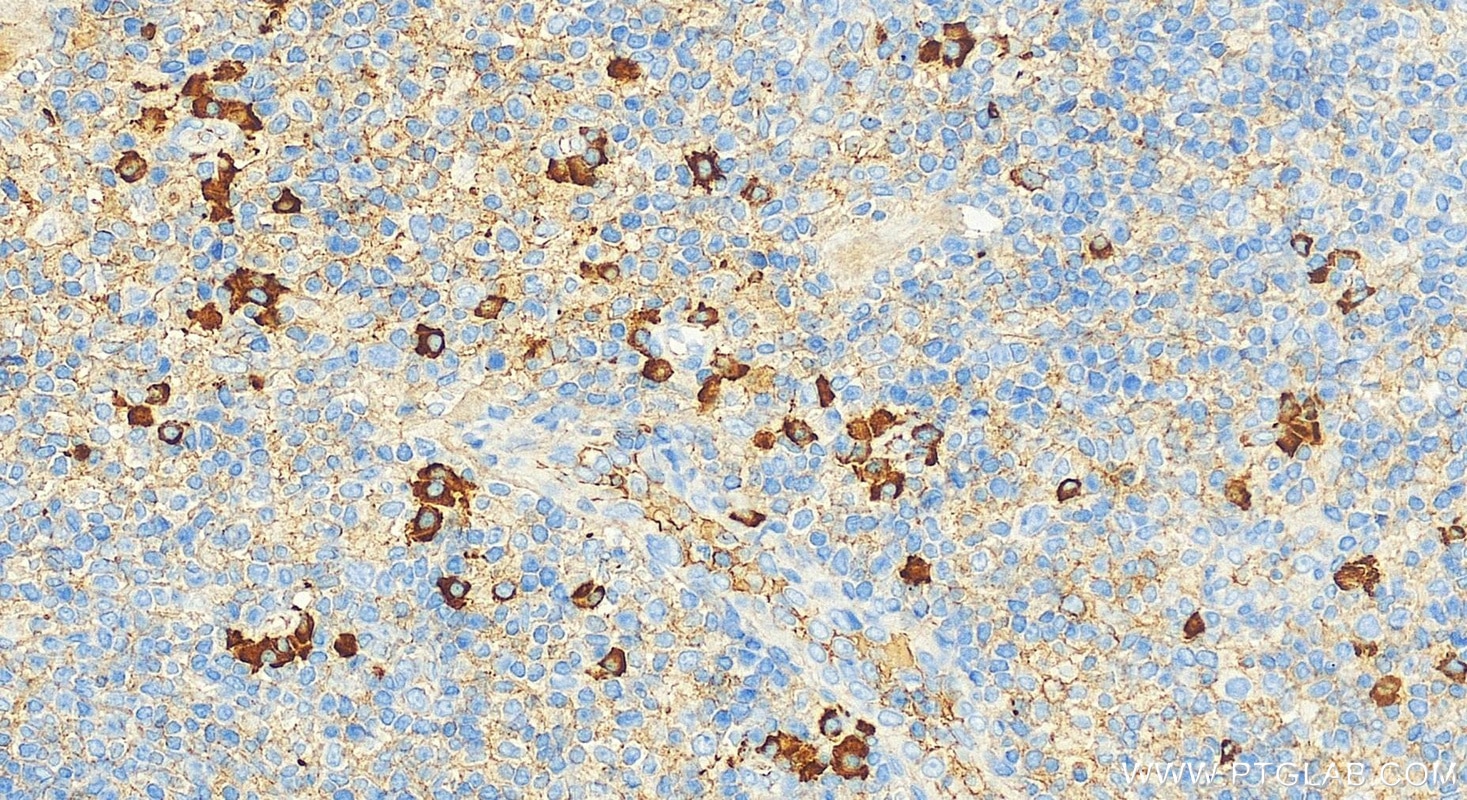Immunohistochemistry (IHC) staining of human tonsillitis tissue using human IgG3 Polyclonal antibody (31495-1-AP)