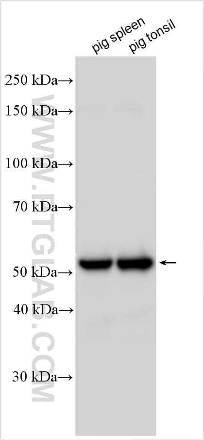 Western Blot (WB) analysis of various lysates using human IgG3 Polyclonal antibody (31495-1-AP)