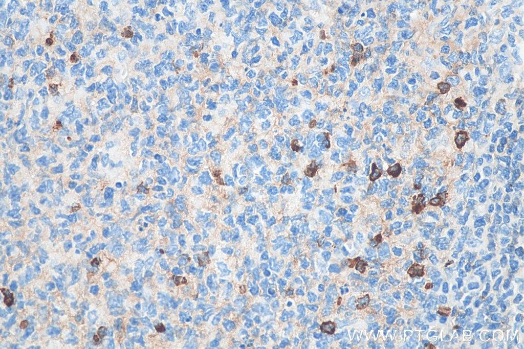 Immunohistochemistry (IHC) staining of human tonsillitis tissue using Biotin-conjugated human IgM Monoclonal antibody (Biotin-66484)