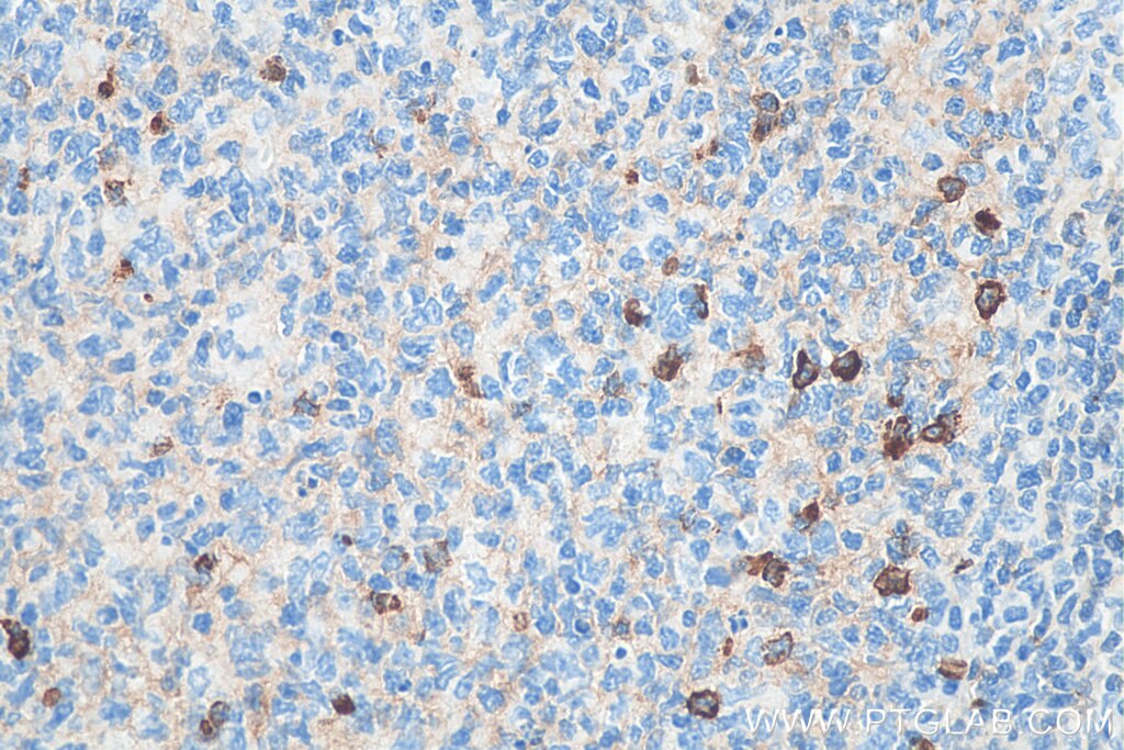 IHC staining of human tonsillitis using Biotin-66484