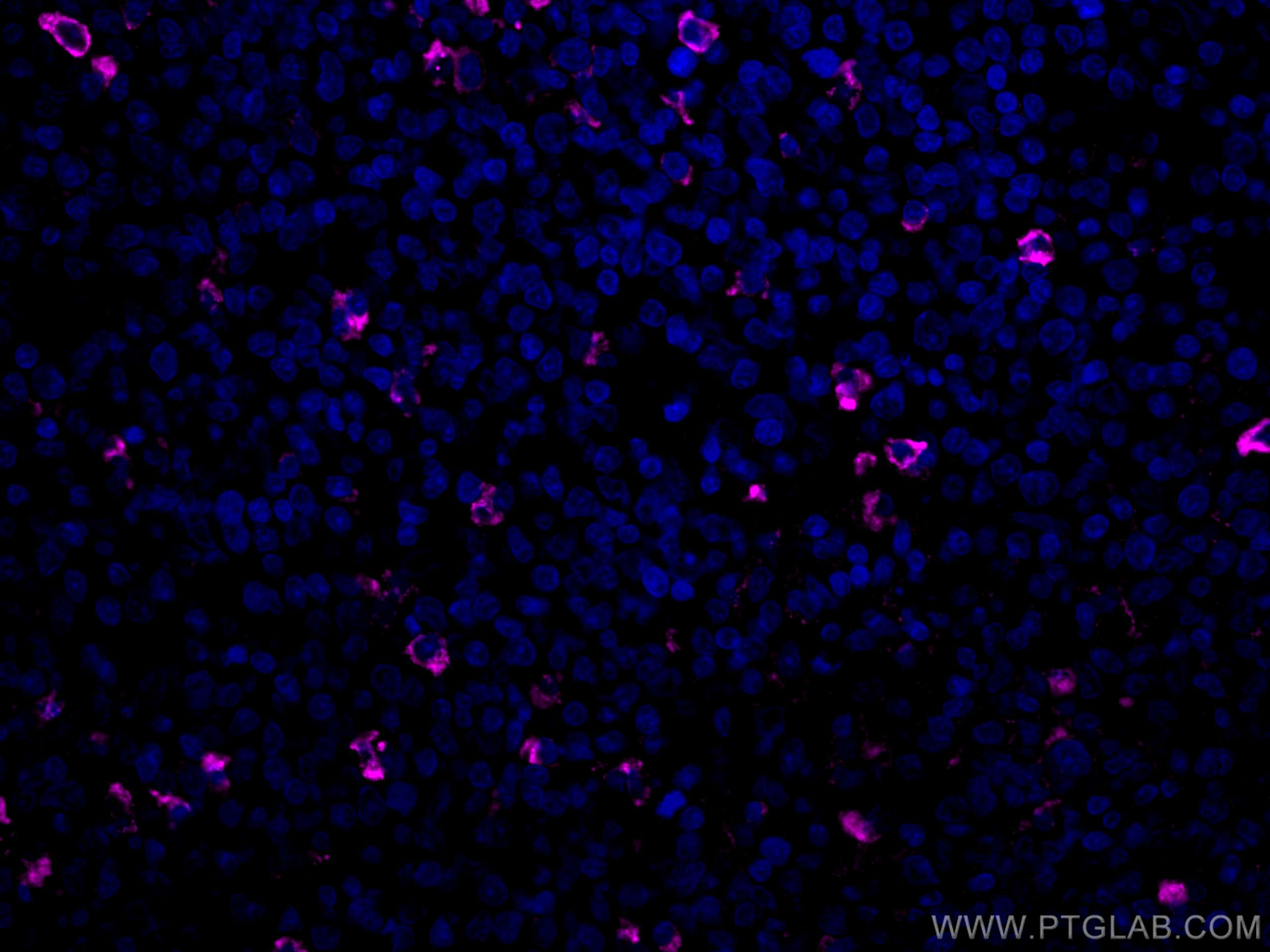 Immunofluorescence (IF) / fluorescent staining of human tonsillitis tissue using CoraLite®647-conjugated human IgM Monoclonal antib (CL647-66484)