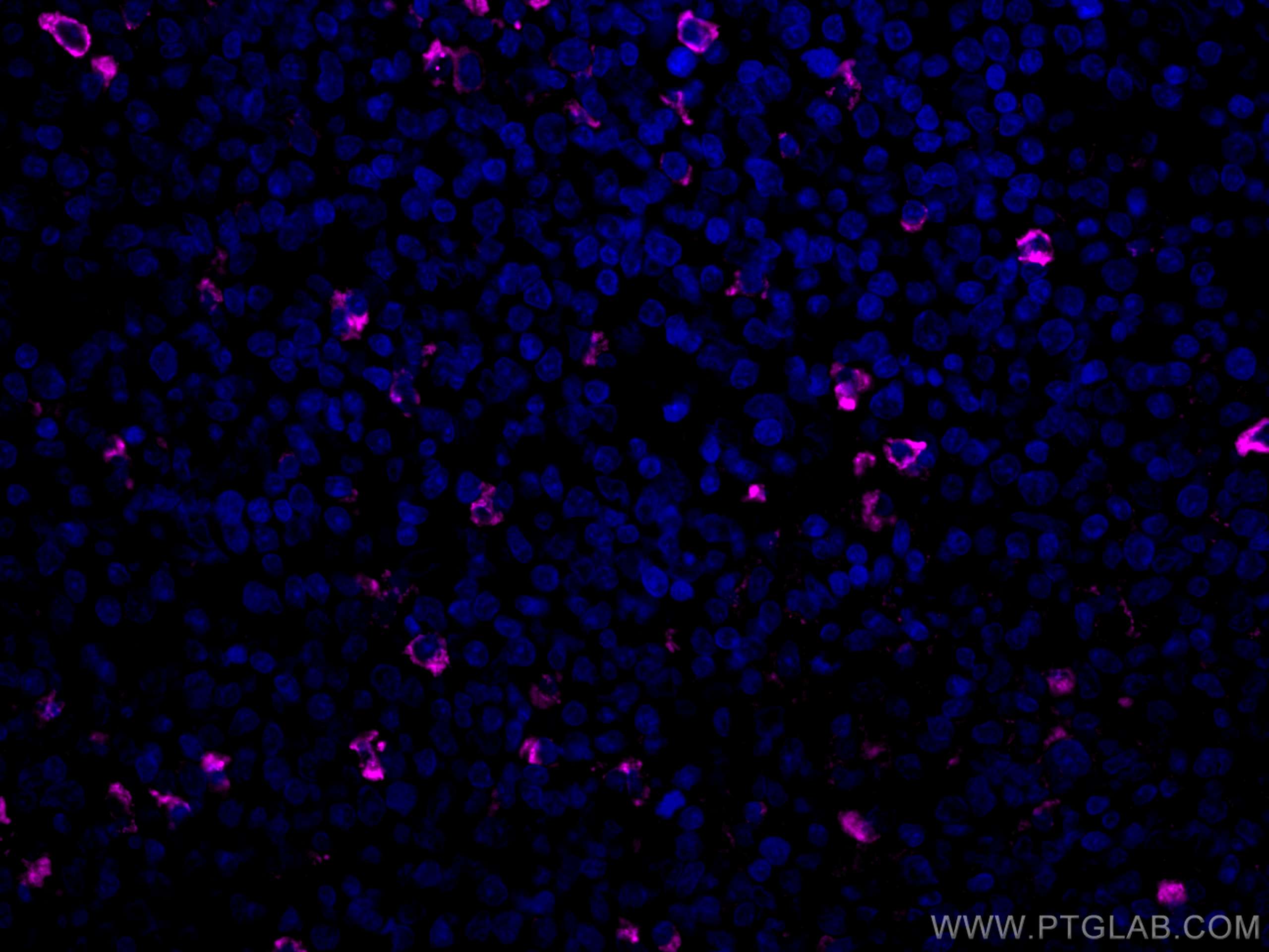 Immunofluorescence (IF) / fluorescent staining of human tonsillitis tissue using CoraLite® Plus 647-conjugated human IgM Monoclonal (CL647-66484)