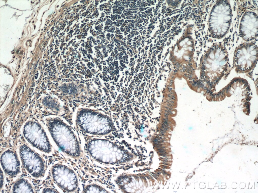 Immunohistochemistry (IHC) staining of human colon tissue using humanin Polyclonal antibody (25886-1-AP)