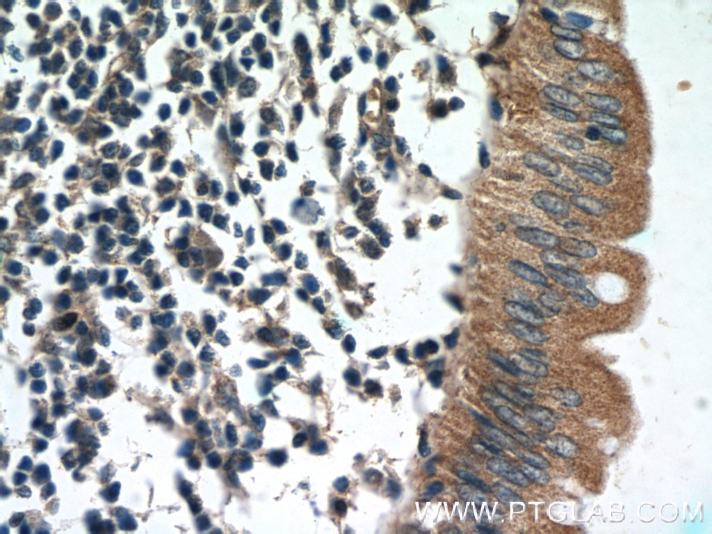 Immunohistochemistry (IHC) staining of human colon tissue using humanin Polyclonal antibody (25886-1-AP)