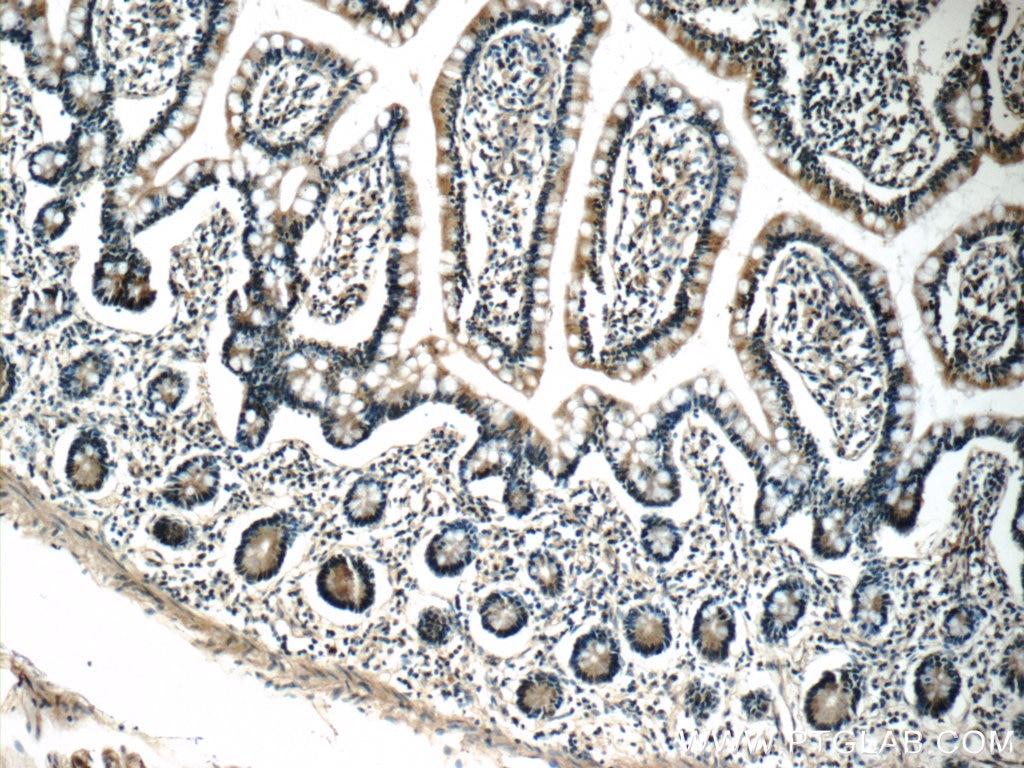 Immunohistochemistry (IHC) staining of human small intestine tissue using humanin Polyclonal antibody (25886-1-AP)