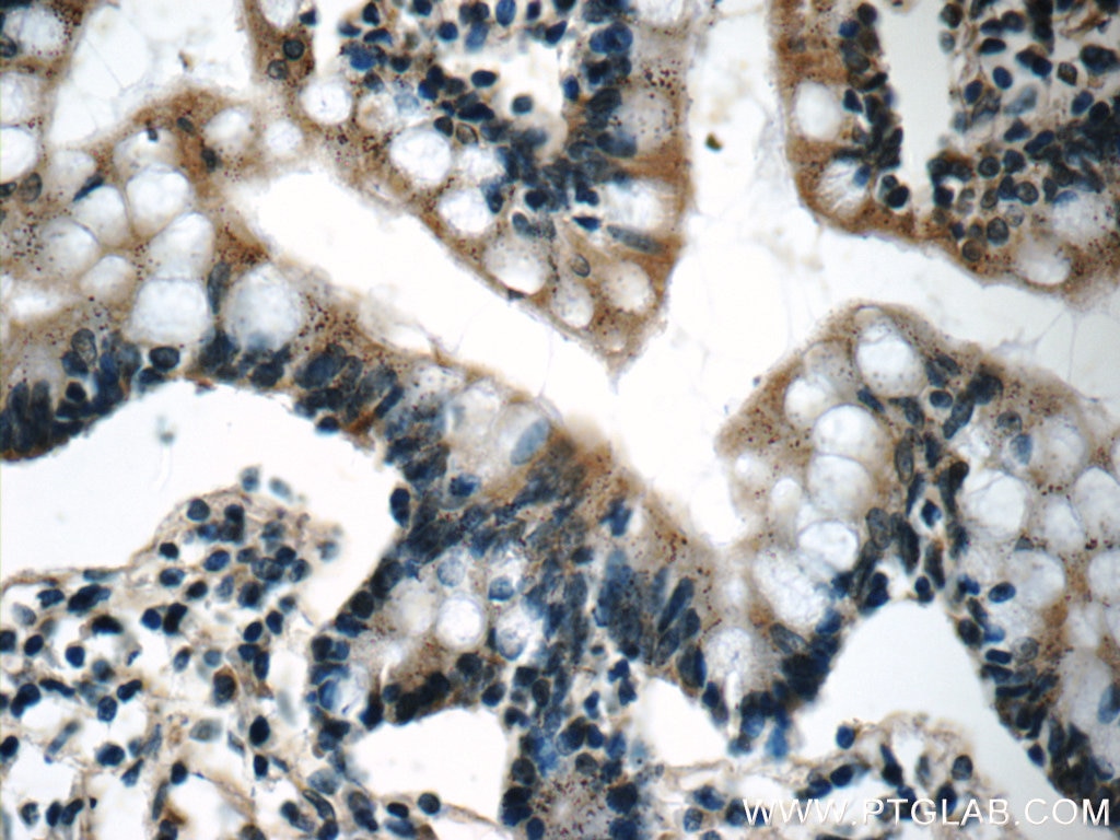Immunohistochemistry (IHC) staining of human small intestine tissue using humanin Polyclonal antibody (25886-1-AP)