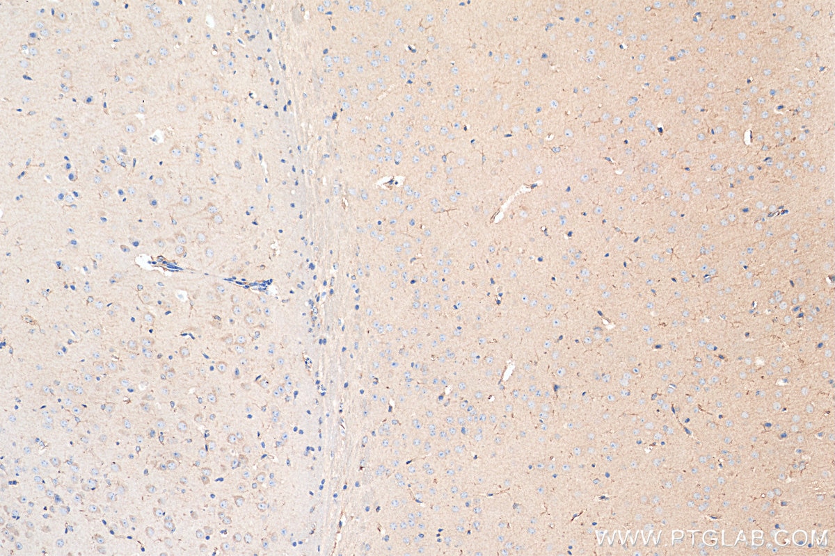 IHC staining of mouse brain using 80517-1-RR