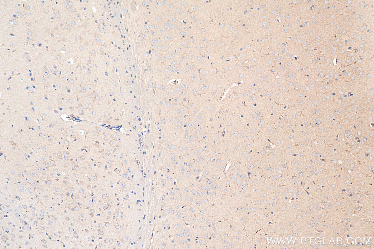 Immunohistochemistry (IHC) staining of mouse brain tissue using iNOS Recombinant antibody (80517-1-RR)