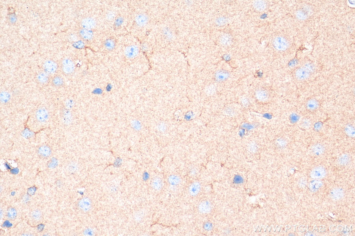 Immunohistochemistry (IHC) staining of mouse brain tissue using iNOS Recombinant antibody (80517-1-RR)