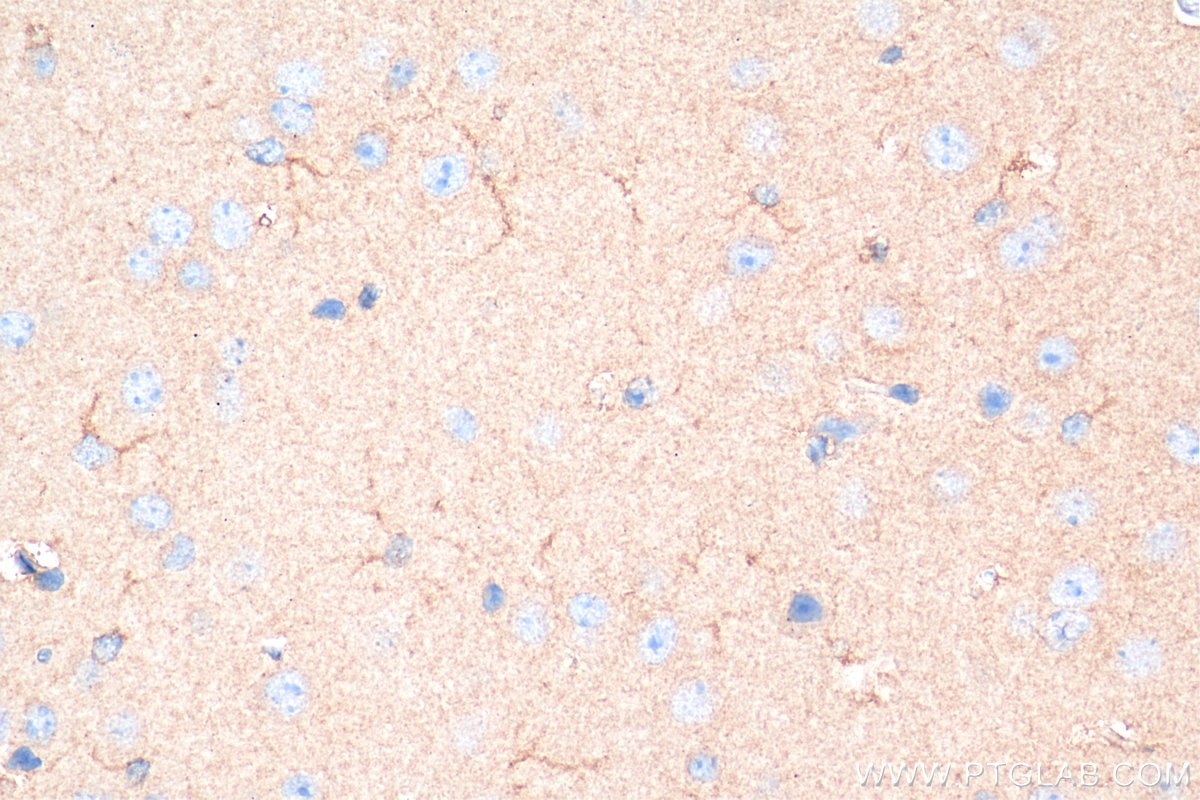 IHC staining of mouse brain using 80517-1-RR