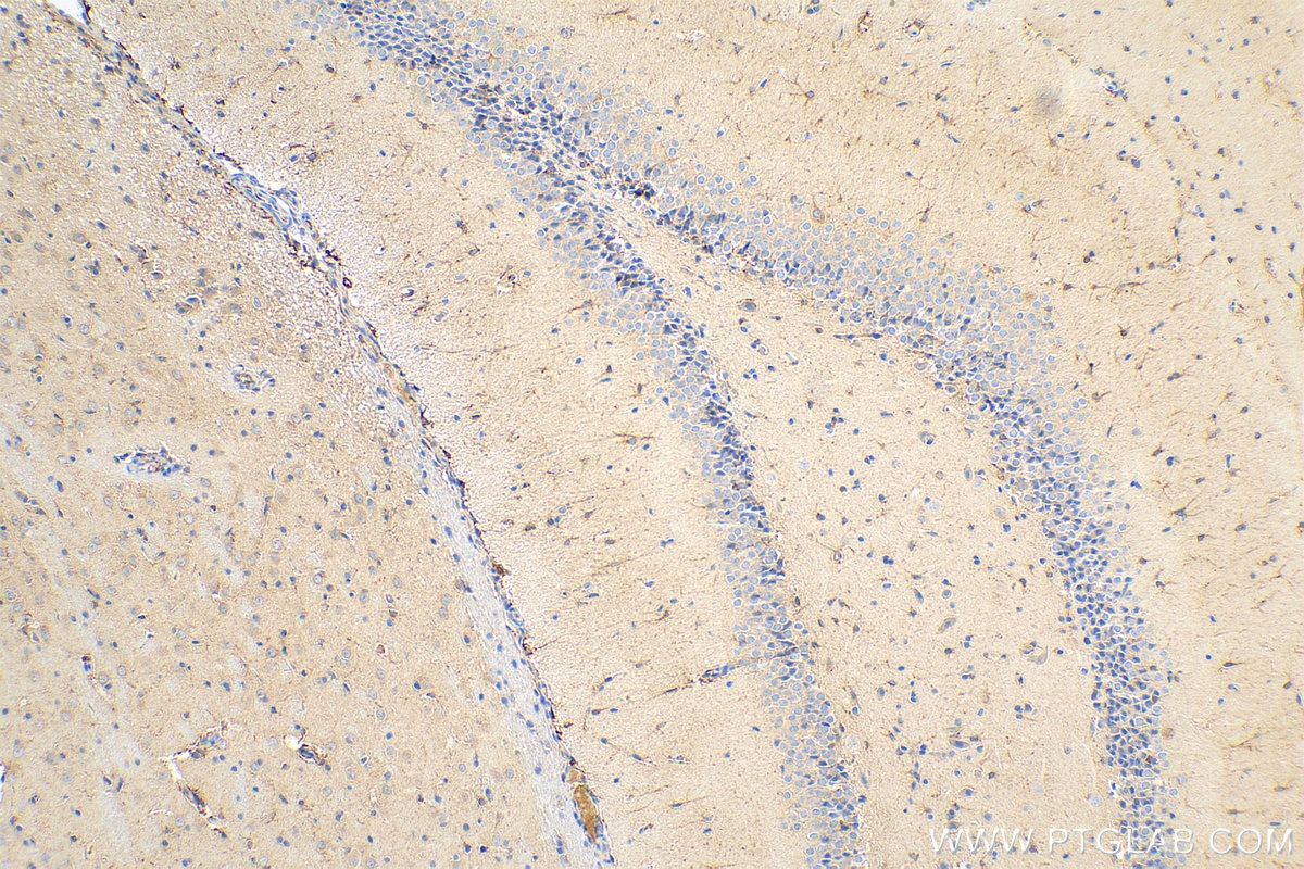 Immunohistochemistry (IHC) staining of rat brain tissue using iNOS Recombinant antibody (80517-1-RR)
