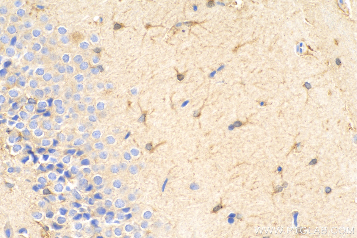 Immunohistochemistry (IHC) staining of rat brain tissue using iNOS Recombinant antibody (80517-1-RR)
