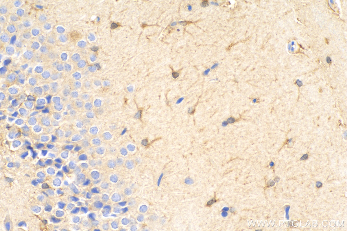 IHC staining of rat brain using 80517-1-RR