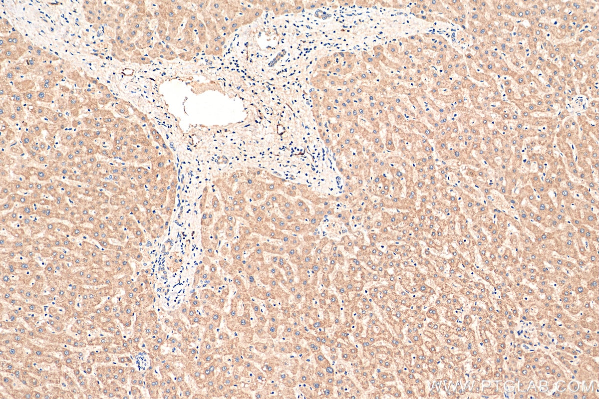 Immunohistochemistry (IHC) staining of human liver tissue using iNOS Recombinant antibody (80517-1-RR)