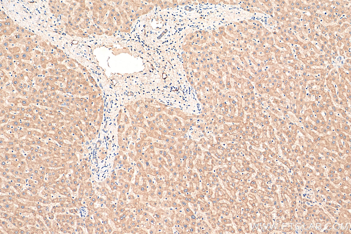 Immunohistochemistry (IHC) staining of human liver tissue using iNOS Recombinant antibody (80517-1-RR)