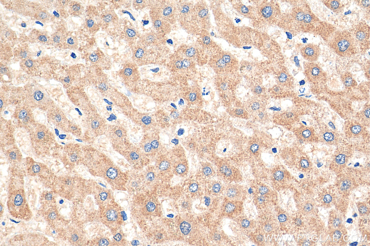 Immunohistochemistry (IHC) staining of human liver tissue using iNOS Recombinant antibody (80517-1-RR)