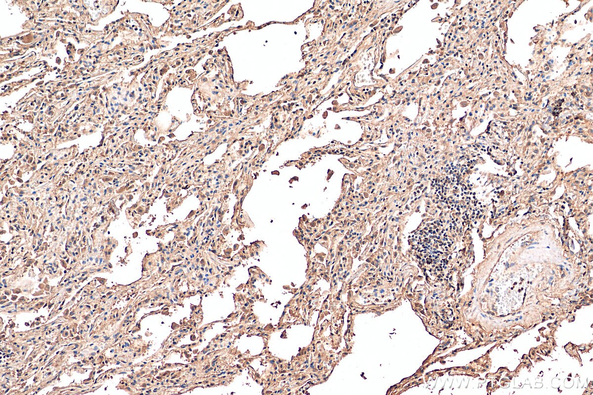 Immunohistochemistry (IHC) staining of human lung tissue using iNOS Recombinant antibody (80517-1-RR)