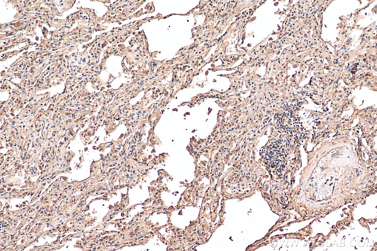 IHC staining of human lung using 80517-1-RR