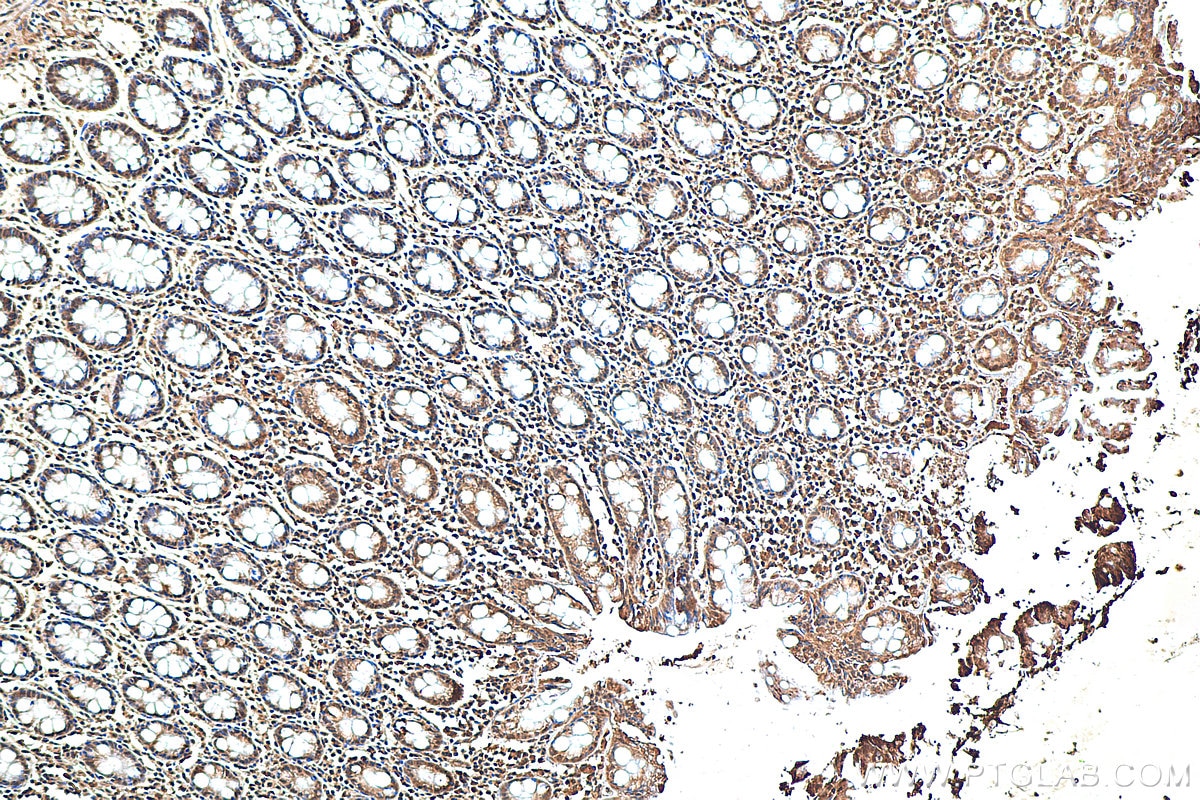 IHC staining of human colon using 80517-1-RR