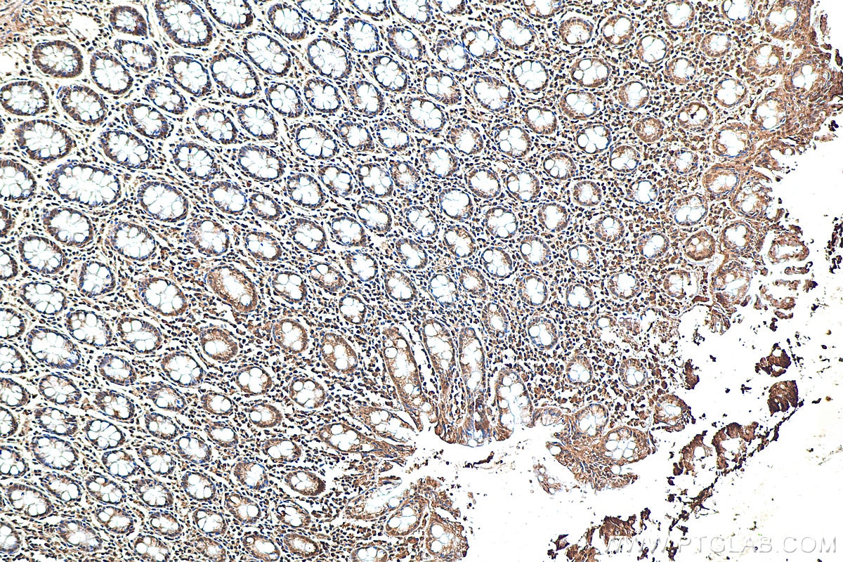 Immunohistochemistry (IHC) staining of human colon tissue using iNOS Recombinant antibody (80517-1-RR)