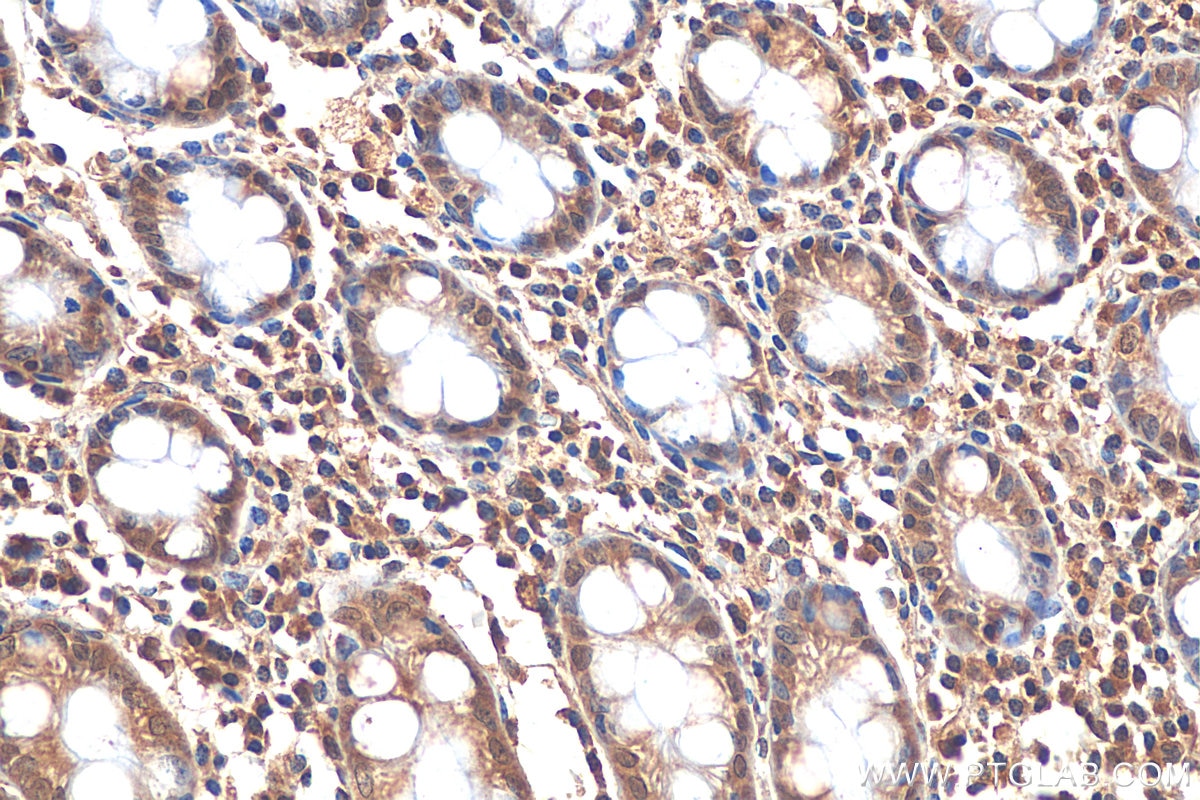 Immunohistochemistry (IHC) staining of human colon tissue using iNOS Recombinant antibody (80517-1-RR)