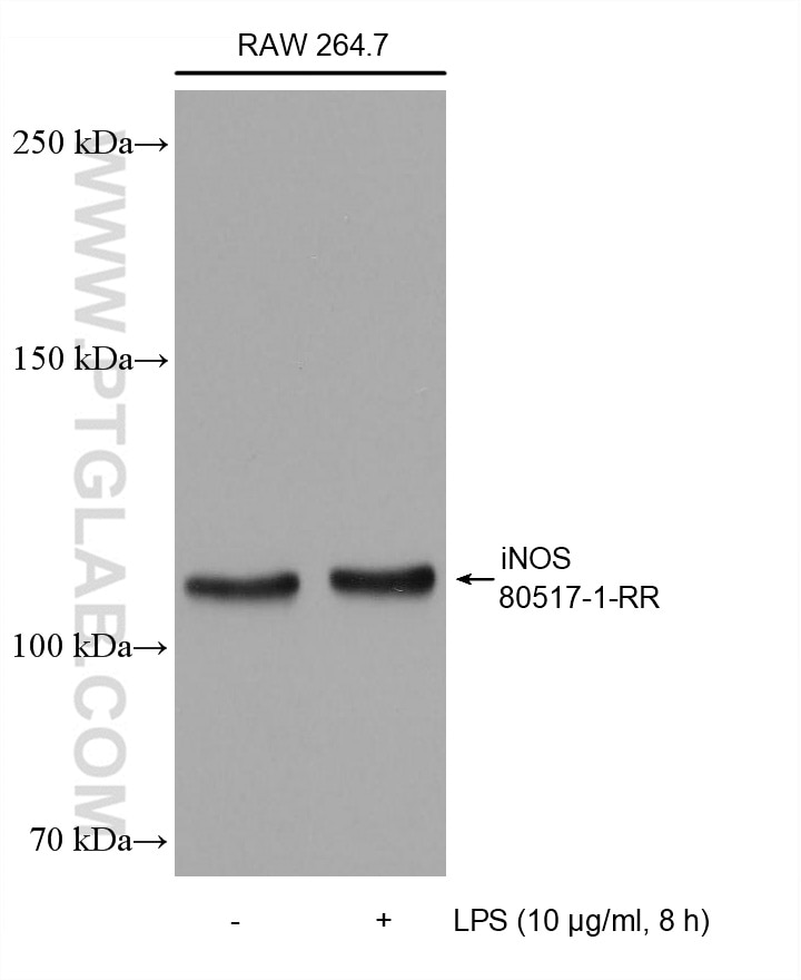 Western Blot (WB) analysis of various lysates using iNOS Recombinant antibody (80517-1-RR)