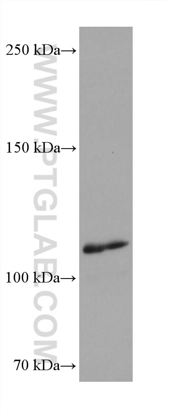 Western Blot (WB) analysis of human PBMCs using iNOS Recombinant antibody (80517-1-RR)