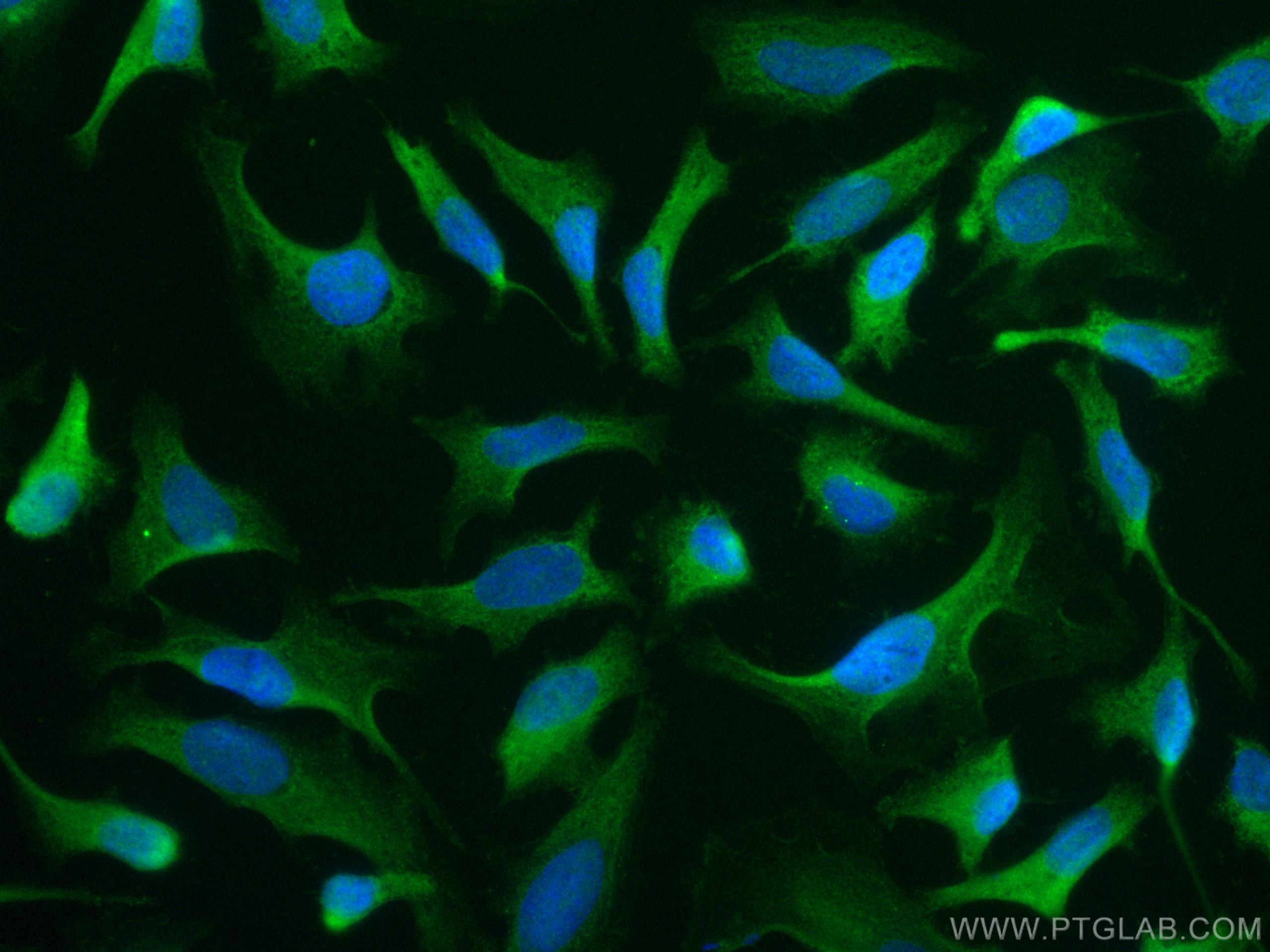 Immunofluorescence (IF) / fluorescent staining of HeLa cells using CoraLite® Plus 488-conjugated iNOS Polyclonal anti (CL488-18985)