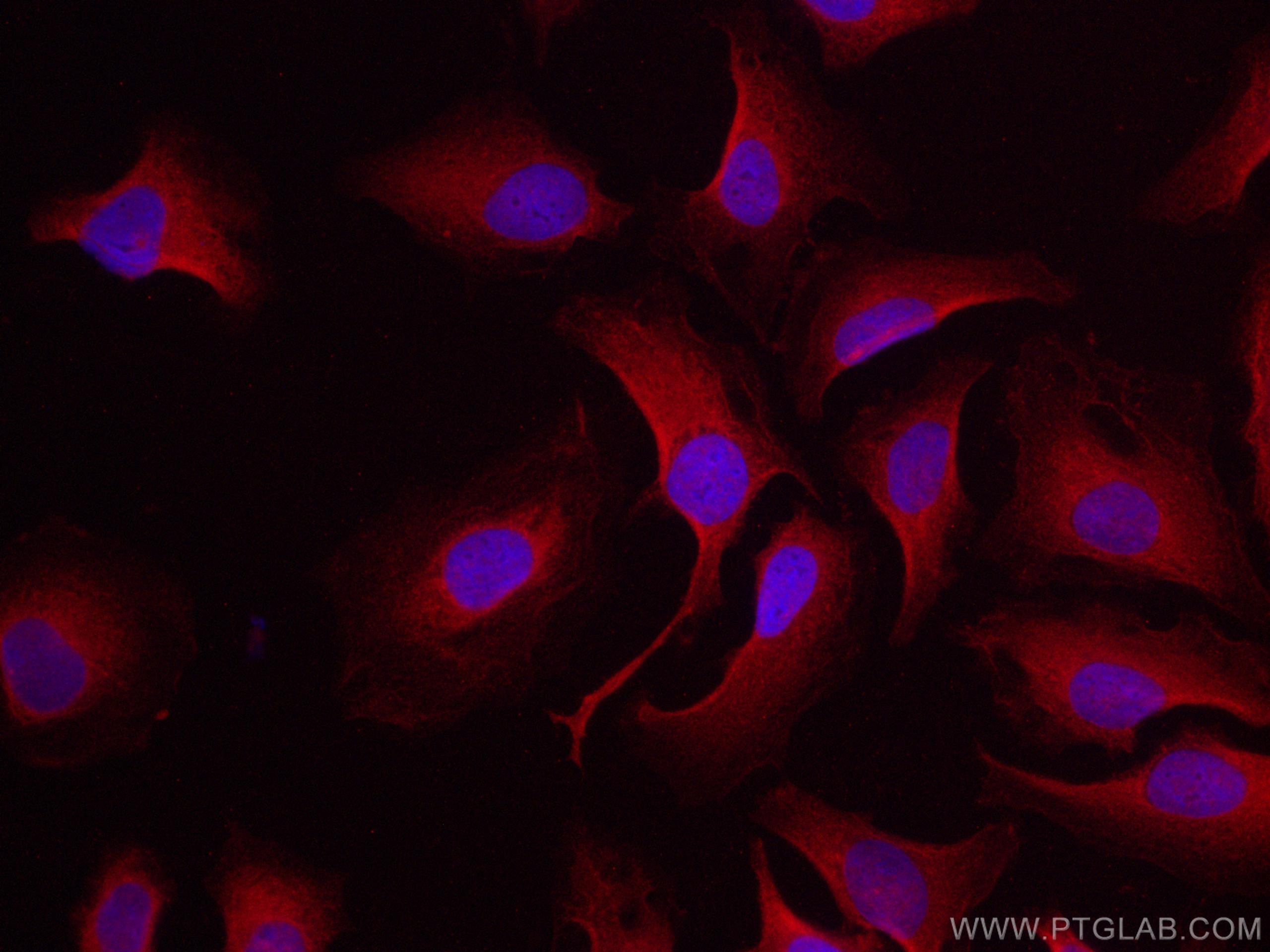 Immunofluorescence (IF) / fluorescent staining of HeLa cells using CoraLite®594-conjugated iNOS Polyclonal antibody (CL594-18985)
