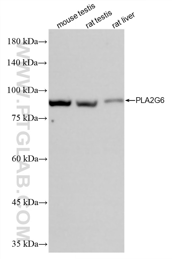 Western Blot (WB) analysis of various lysates using iPLA2 Recombinant monoclonal antibody (86812-1-RR)